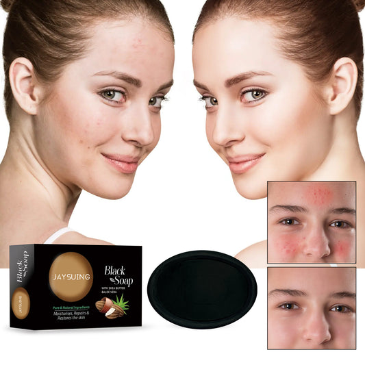 Shea Butter Black Soap, Repair Acne Pimple Acne Clear Pores Moisturize Smooth Skin Soap